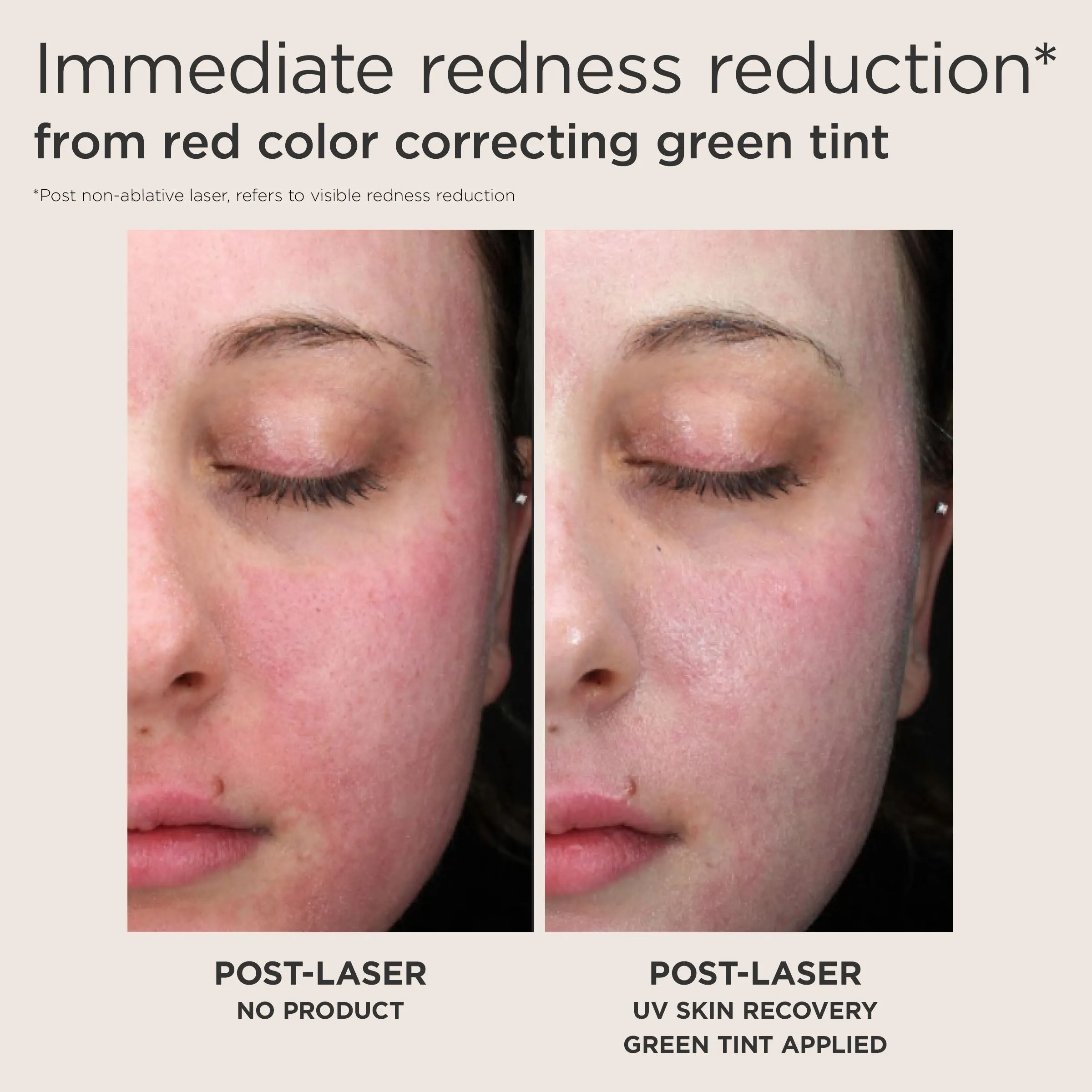 EltaMD Post-Procedure Bundled Kit